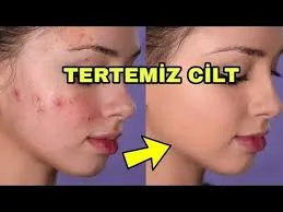 Benzoxin Krem Nasıl Uygulanır