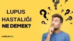 Lupus ne demek? Lupus hastalığı nedir? Lupus (kelebek) hastalığının belirtileri neler?